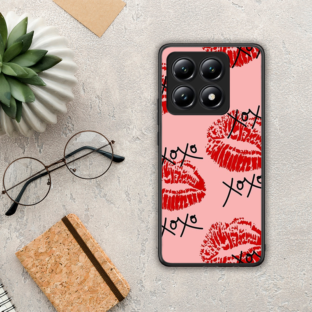 XOXO Lips - Xiaomi 14T θήκη