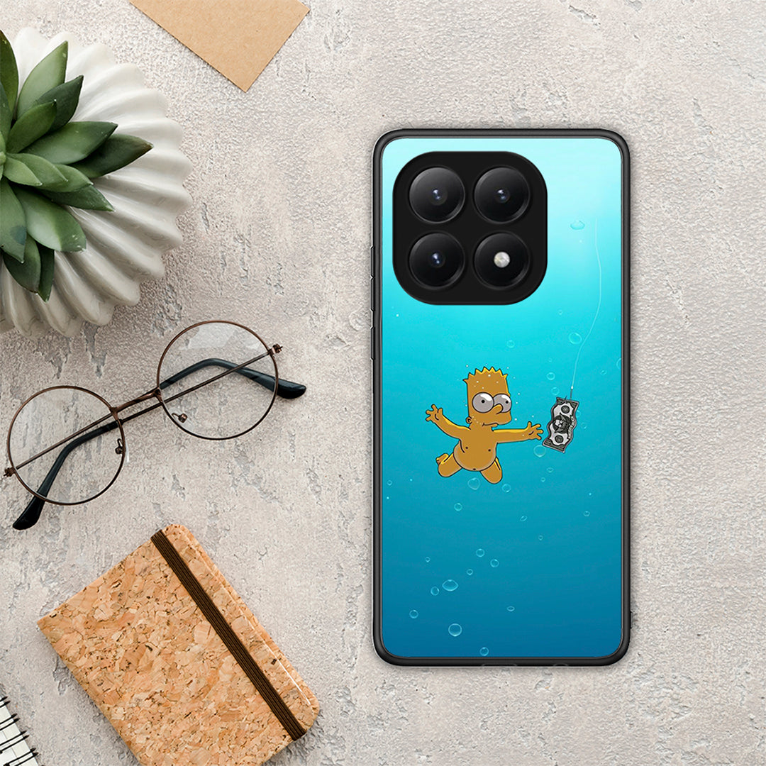 Chasing Money - Xiaomi 15T θήκη