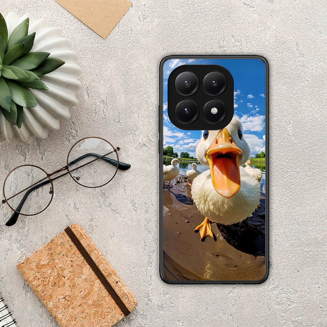 Duck Face - Xiaomi 15T θήκη