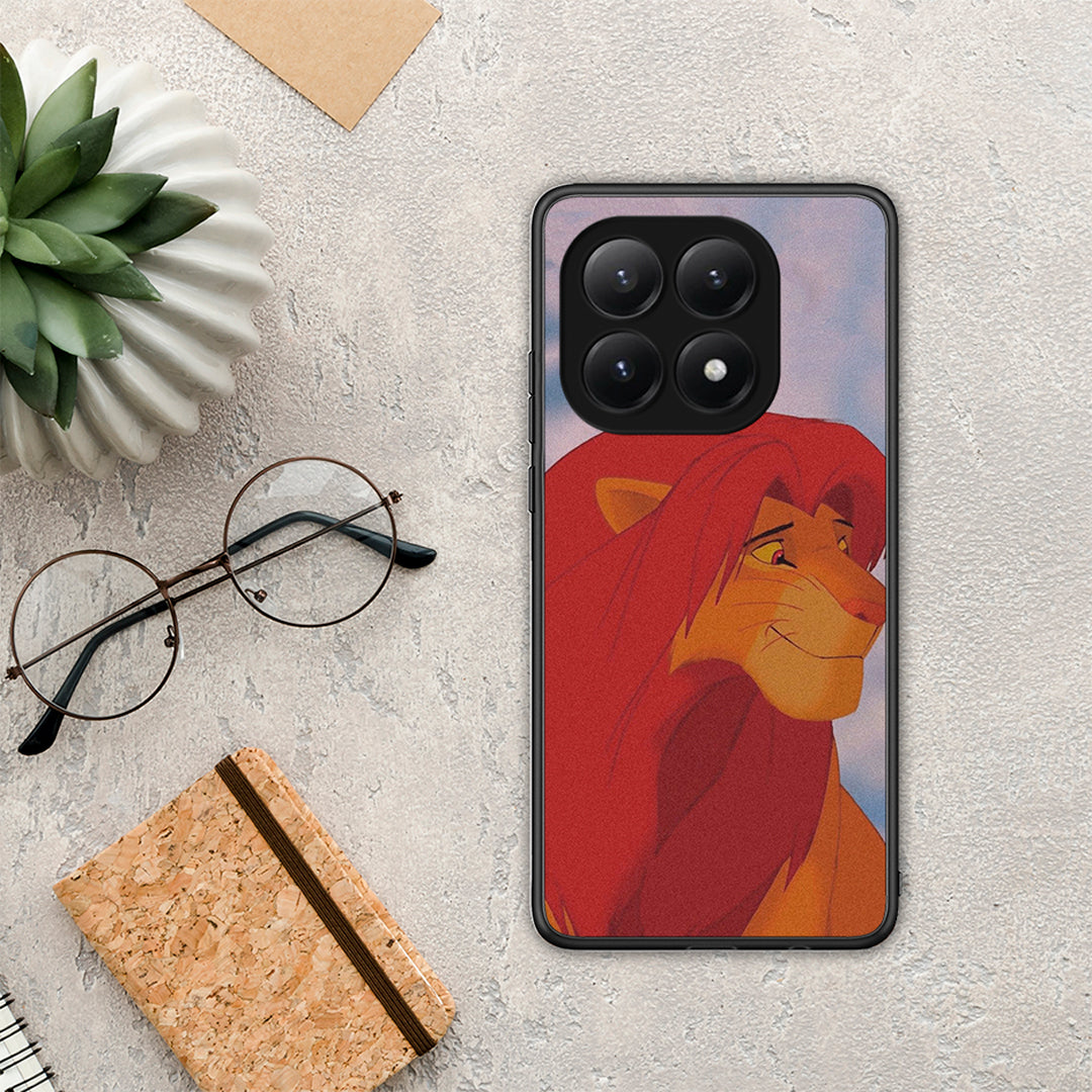 Lion Love 1 - Xiaomi 15T θήκη