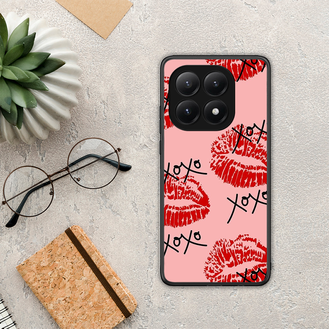 XOXO Lips - Xiaomi 15T θήκη