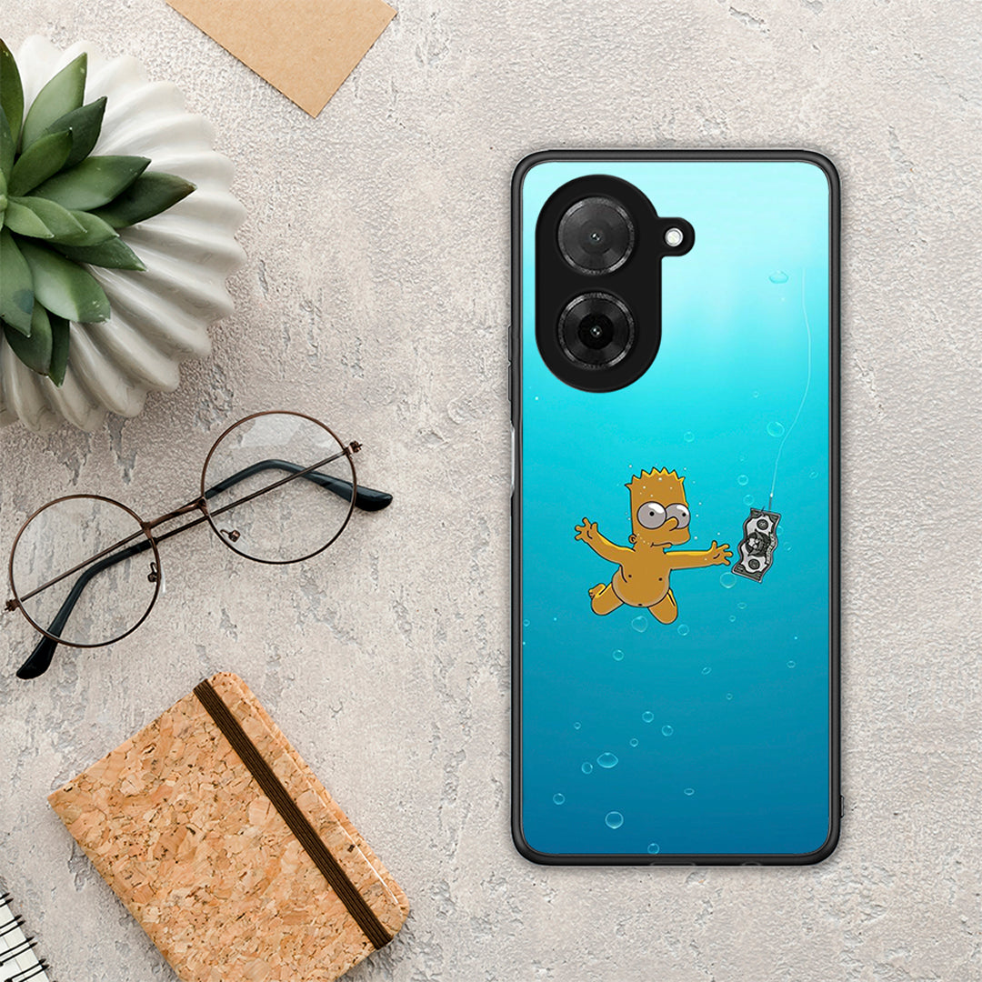 Chasing Money - Xiaomi Redmi A5 θήκη