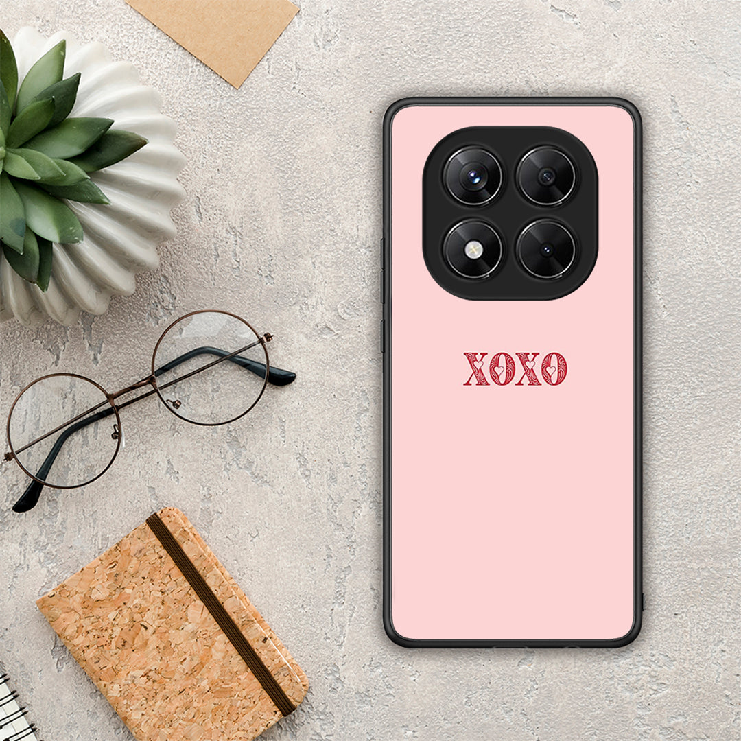 XOXO Love - Xiaomi Redmi Note 14 Pro 5G / Poco X7 θήκη