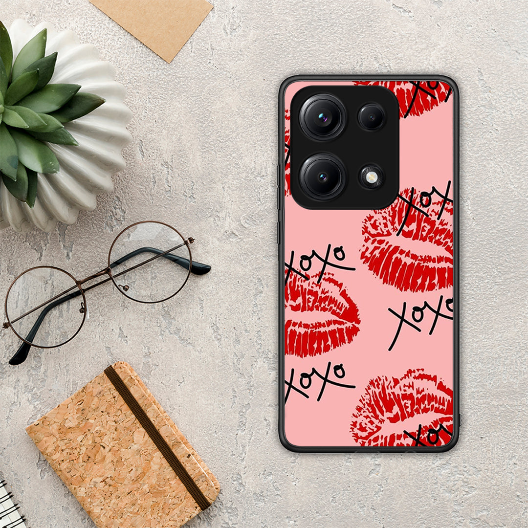 XOXO Lips - Xiaomi Redmi Note 14S θήκη