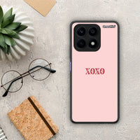Thumbnail for Θήκη Honor X8a XOXO Love από τη Smartfits με σχέδιο στο πίσω μέρος και μαύρο περίβλημα | Honor X8a XOXO Love Case with Colorful Back and Black Bezels