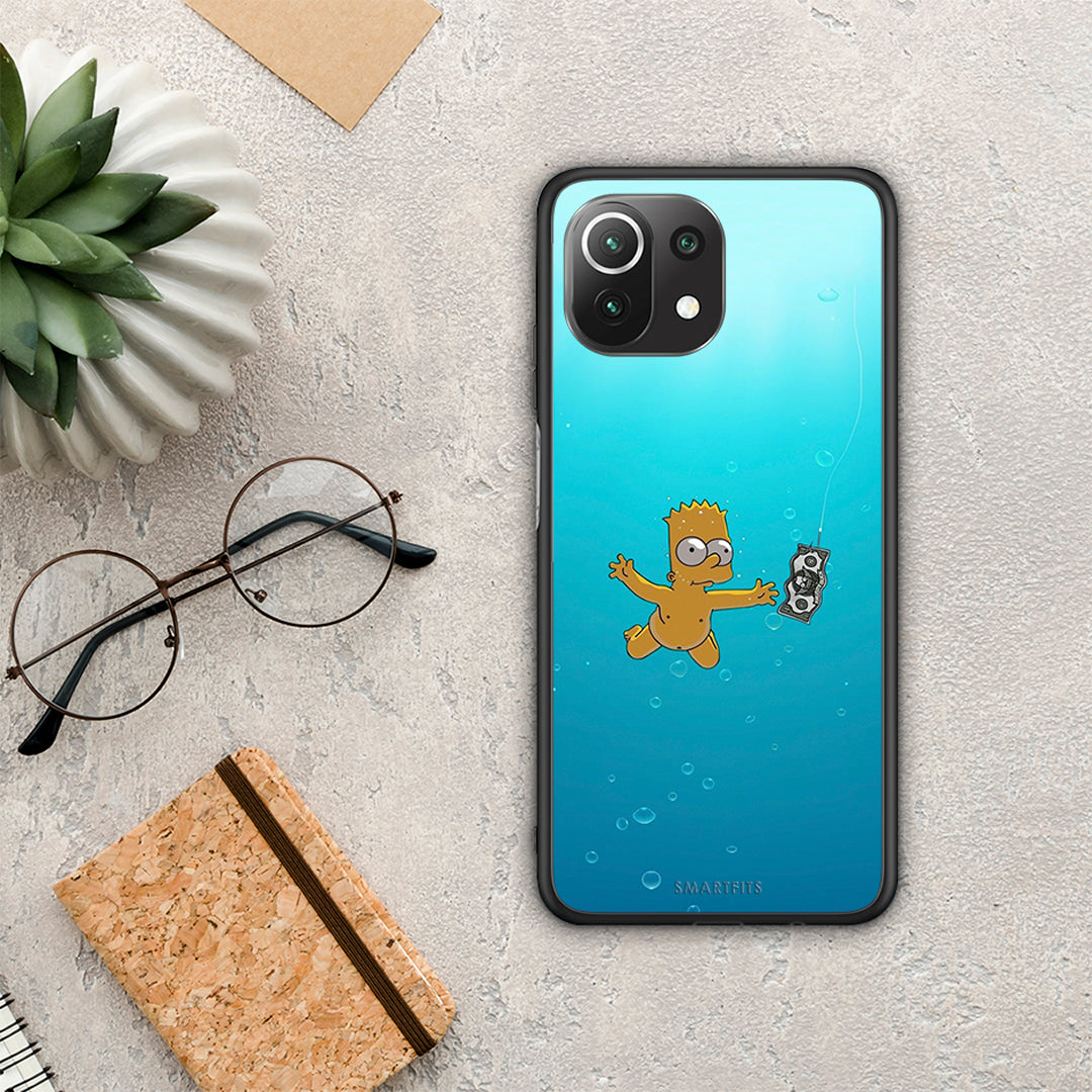 Chasing Money - Xiaomi 11 Lite 5G NE / Mi 11 Lite θήκη