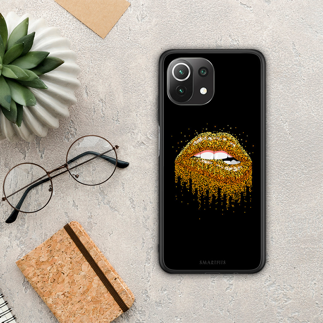 Valentine Golden - Xiaomi 11 Lite 5G NE / Mi 11 Lite θήκη