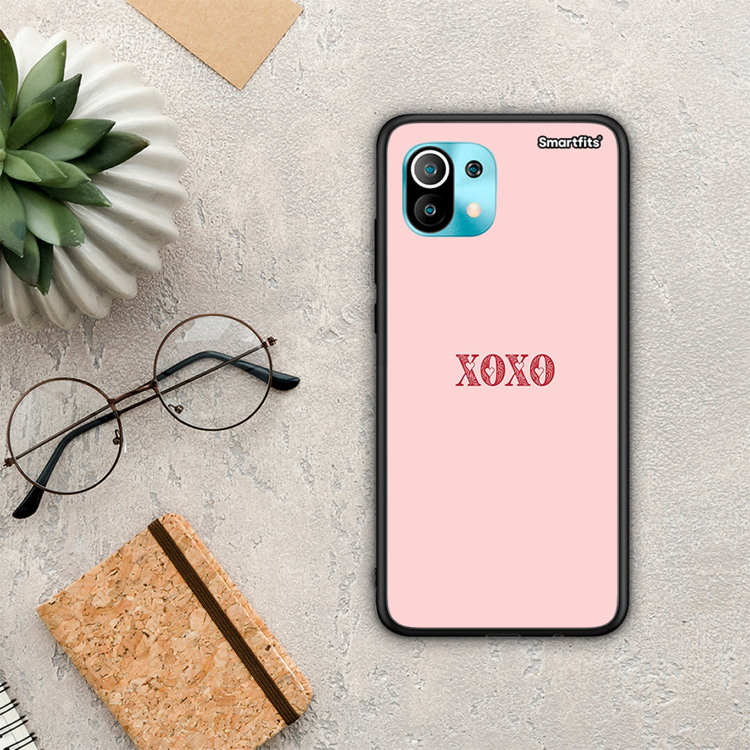 XOXO Love - Xiaomi Mi 11 / 11 Pro θήκη