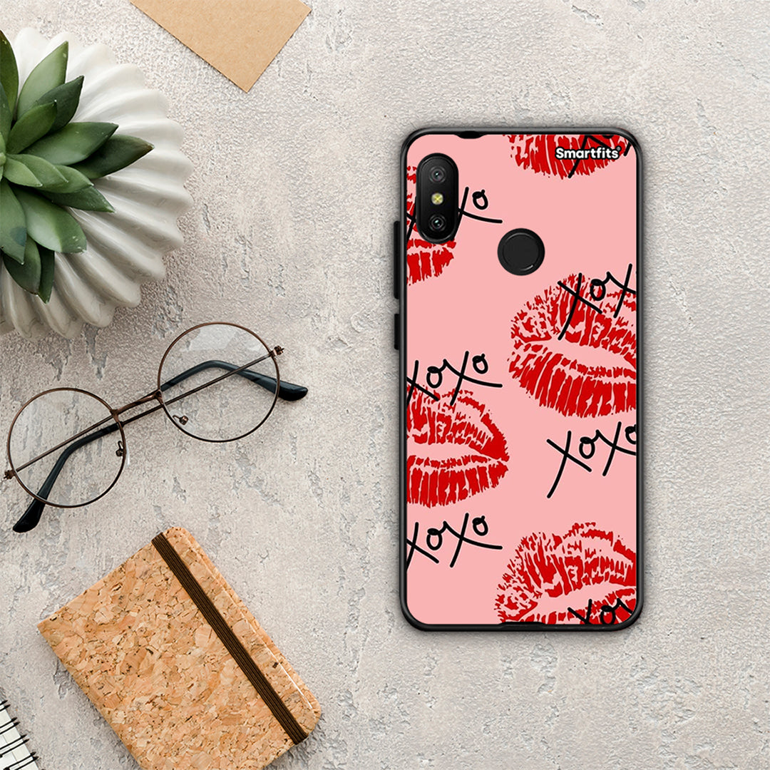 XOXO Lips - Xiaomi Mi A2 Lite θήκη