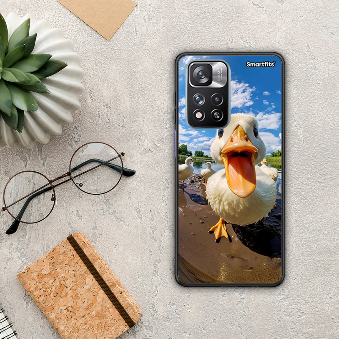 Duck Face - Xiaomi Redmi Note 11 Pro+ 5G θήκη