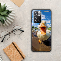Thumbnail for Duck Face - Xiaomi Redmi Note 11 Pro+ 5G θήκη