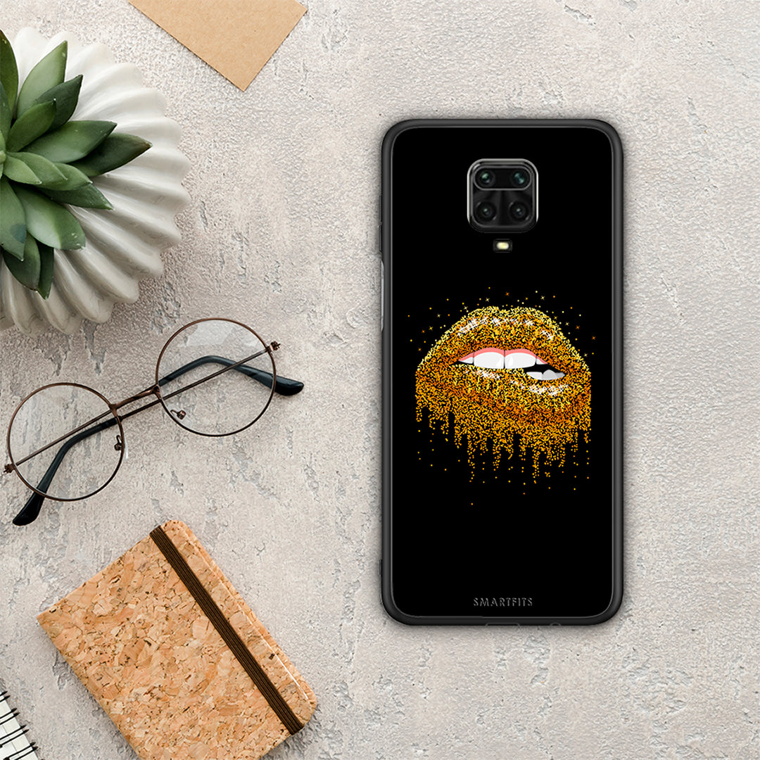Valentine Golden - Xiaomi Redmi Note 9S / 9 Pro / 9 Pro Max θήκη