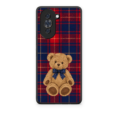 Θήκη Huawei Nova 10 Teddy Bear on Red and Navy Tartan από τη Smartfits με σχέδιο στο πίσω μέρος και μαύρο περίβλημα | Huawei Nova 10 Teddy Bear on Red and Navy Tartan case with colorful back and black bezels