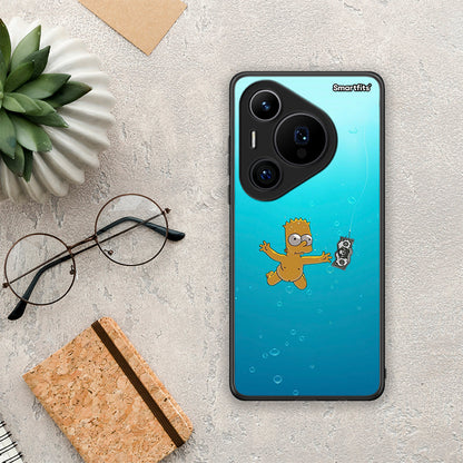 Chasing Money - Huawei Pura 70 Pro / 70 Pro+ θήκη