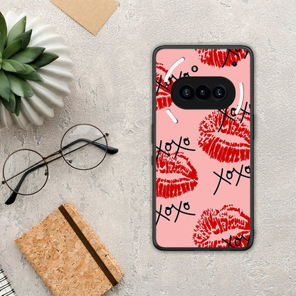 XOXO Lips - Nothing Phone 3a θήκη