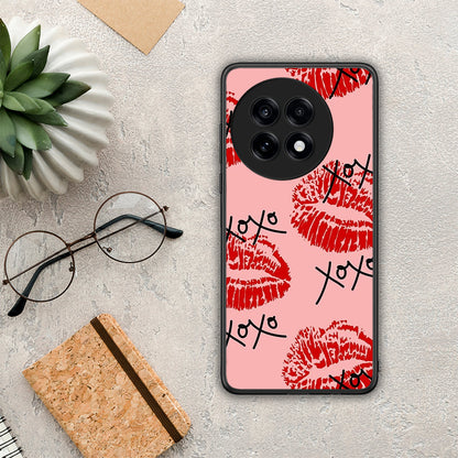 XOXO Lips - OnePlus 13R θήκη