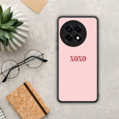 XOXO Love - OnePlus 13R θήκη