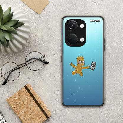 Chasing Money - OnePlus Nord 3 θήκη