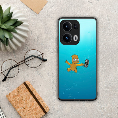 Chasing Money - Oppo Reno13 Pro θήκη