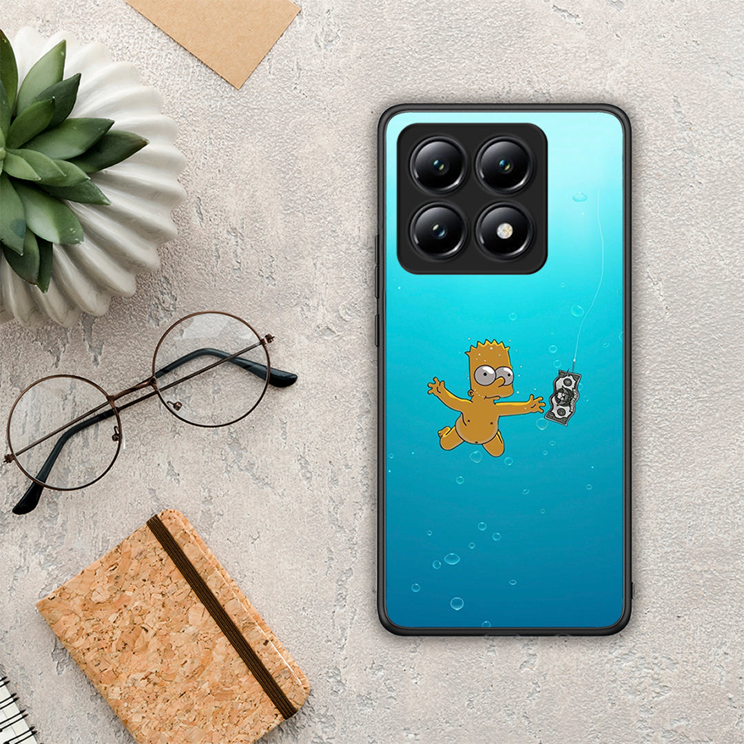 Chasing Money - Xiaomi 14T θήκη