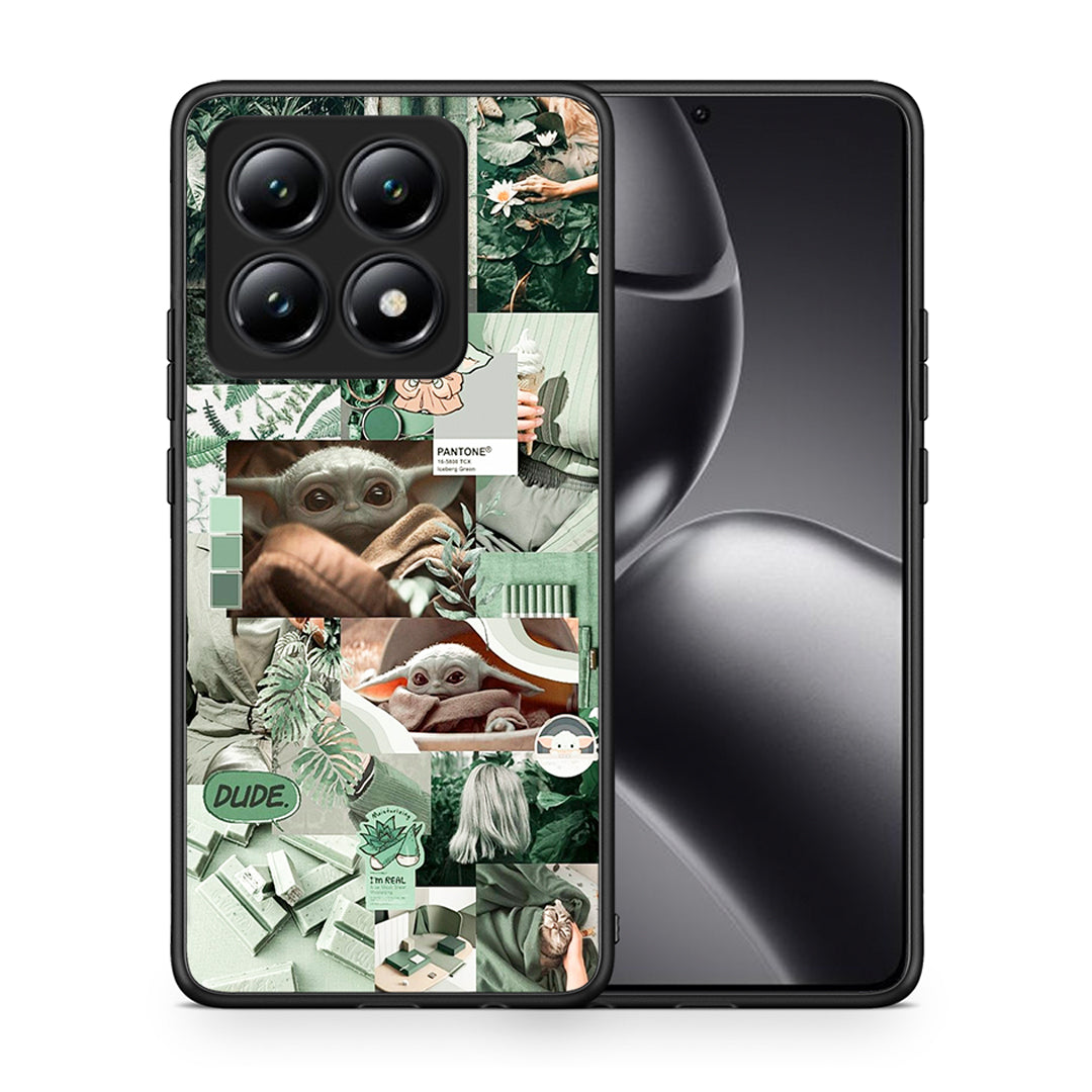 Collage Dude - Xiaomi 14T θήκη