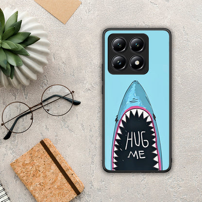 Hug Me - Xiaomi 14T θήκη