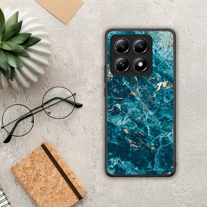 Marble Blue - Xiaomi 14T θήκη