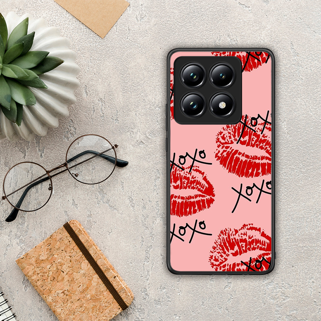 XOXO Lips - Xiaomi 14T Pro θήκη