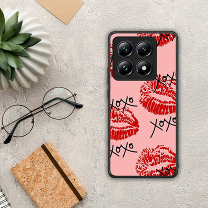 XOXO Lips - Xiaomi 14T Pro θήκη