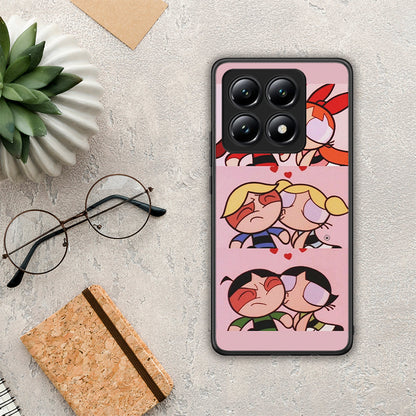 Puff Love - Xiaomi 14T θήκη
