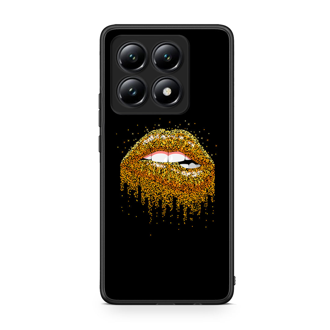 4 - Xiaomi 14T Golden Valentine case, cover, bumper