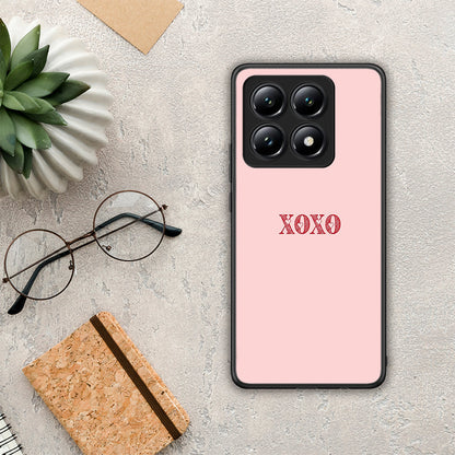 XOXO Love - Xiaomi 14T θήκη