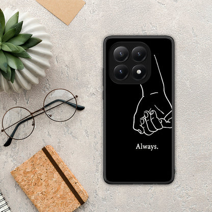 Always & Forever 1 - Xiaomi 15T θήκη