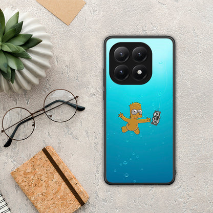 Chasing Money - Xiaomi 15T θήκη