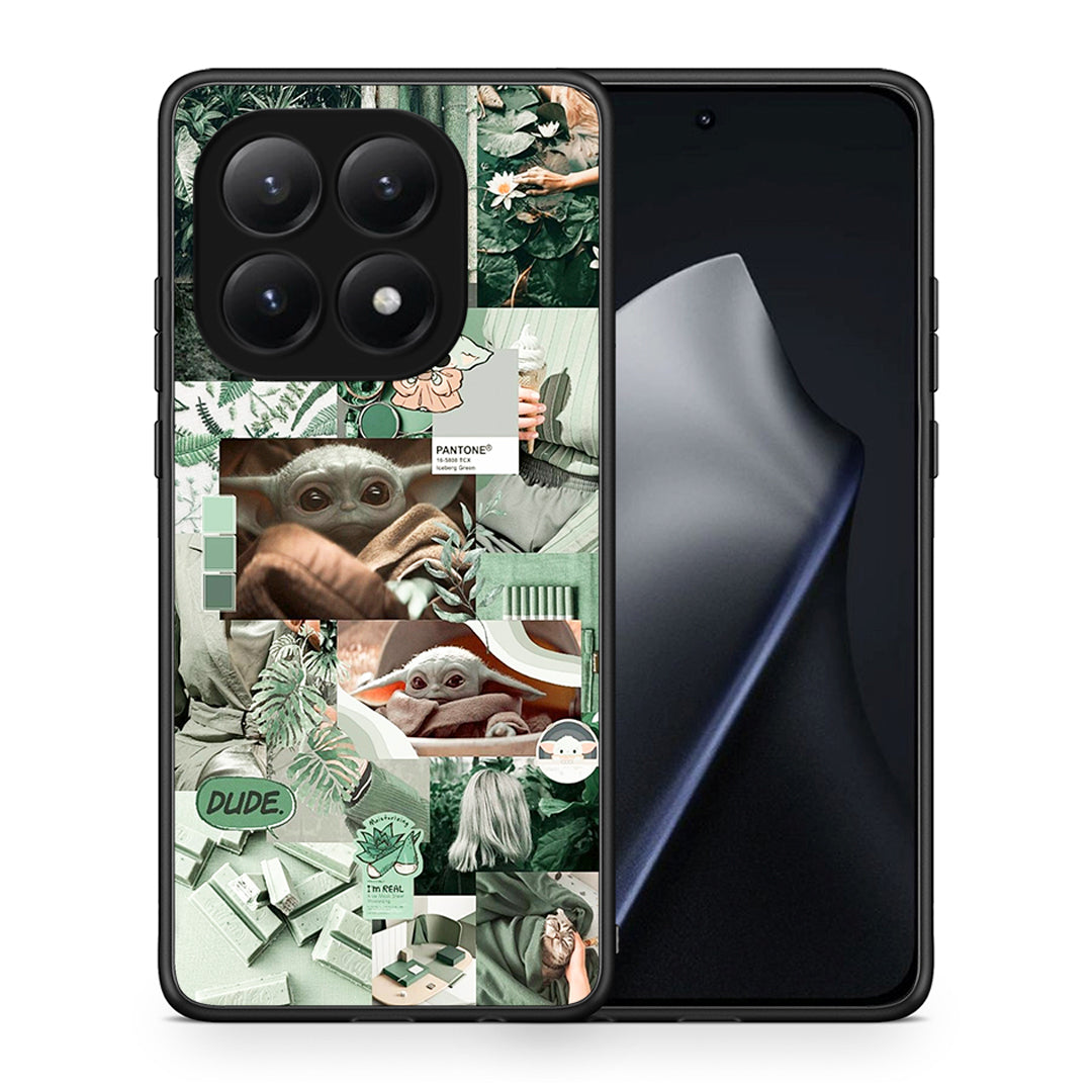 Collage Dude - Xiaomi 15T θήκη