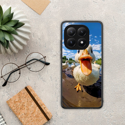 Duck Face - Xiaomi 15T θήκη