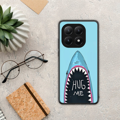 Hug Me - Xiaomi 15T θήκη