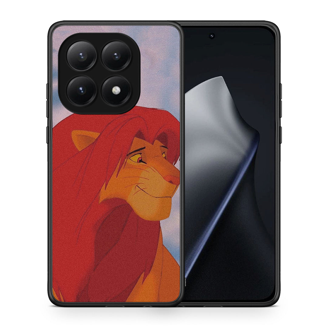 Lion Love 1 - Xiaomi 15T θήκη