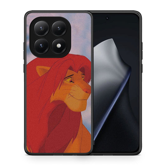Lion Love 1 - Xiaomi 15T θήκη