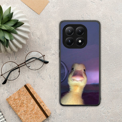 Meme Duck - Xiaomi 15T θήκη