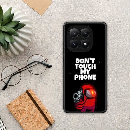 My Phone - Xiaomi 15T θήκη