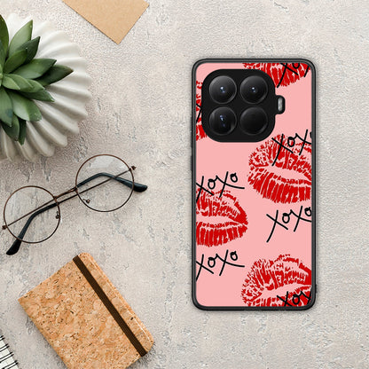 XOXO Lips - Xiaomi 15T Pro θήκη