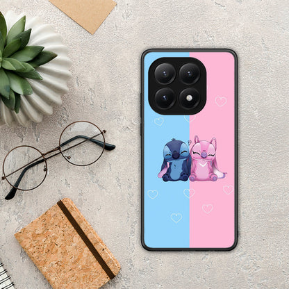 Stitch And Angel - Xiaomi 15T θήκη