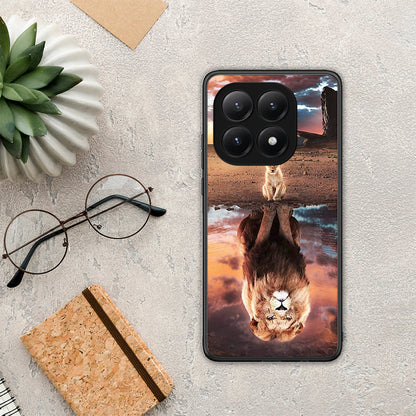 Sunset Dreams - Xiaomi 15T θήκη
