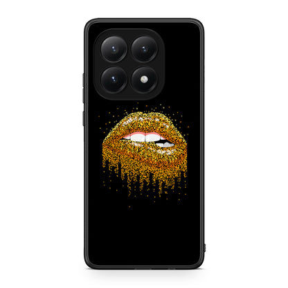4 - Xiaomi 15T Golden Valentine case, cover, bumper