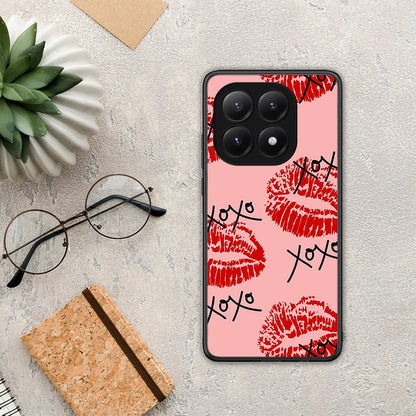XOXO Lips - Xiaomi 15T θήκη