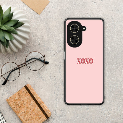 XOXO Love - Xiaomi Poco C71 θήκη