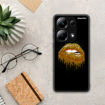 Valentine Golden - Xiaomi Redmi Note 13 Pro 4G θήκη