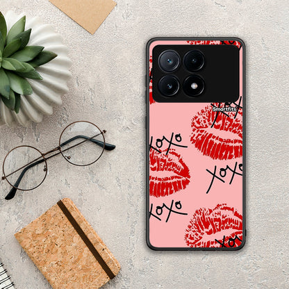 XOXO Lips - Xiaomi Poco X6 Pro 5G θήκη