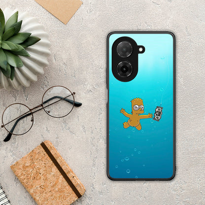 Chasing Money - Xiaomi Redmi A5 θήκη
